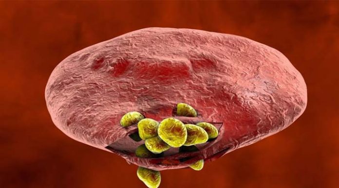malaria malaria