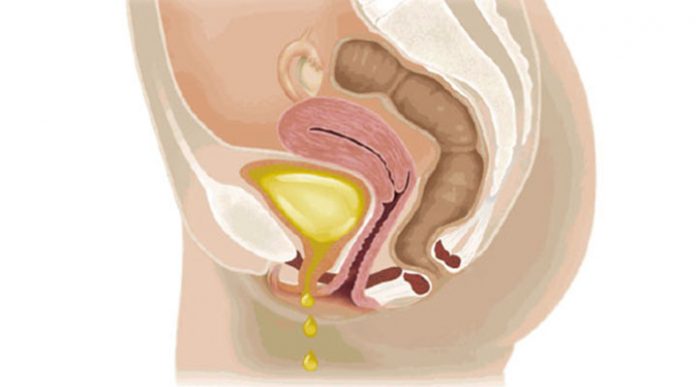 urinaria