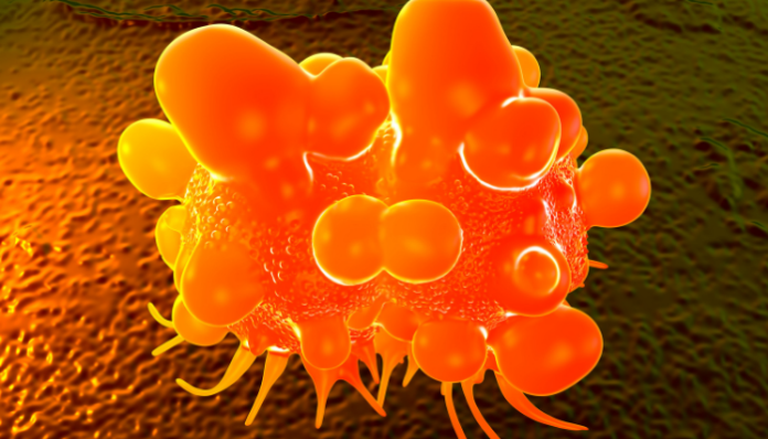 cáncer intestinal intestinal