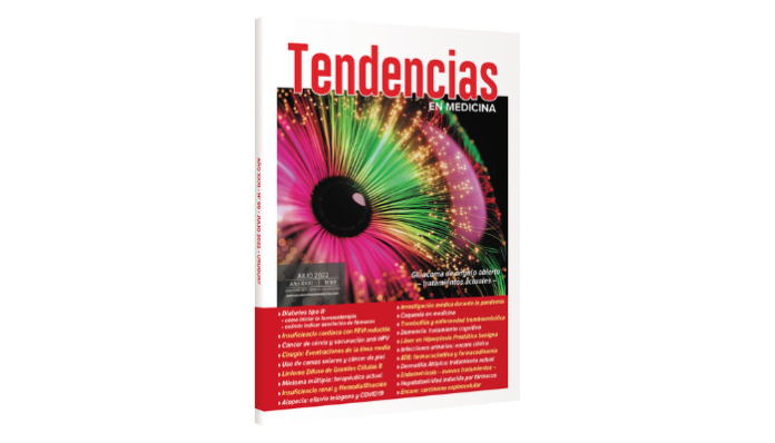 tendencias para porta